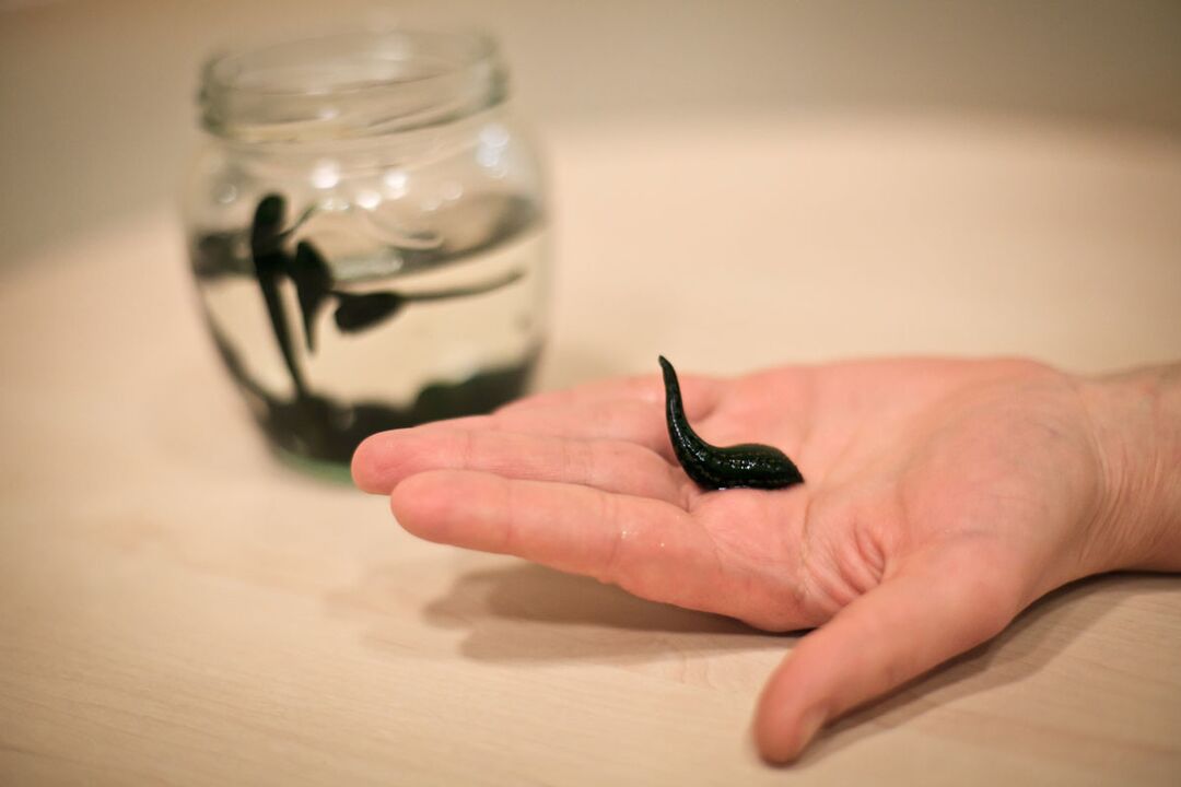 Leeches will serve as raw material for the production of a cream that stimulates penis growth